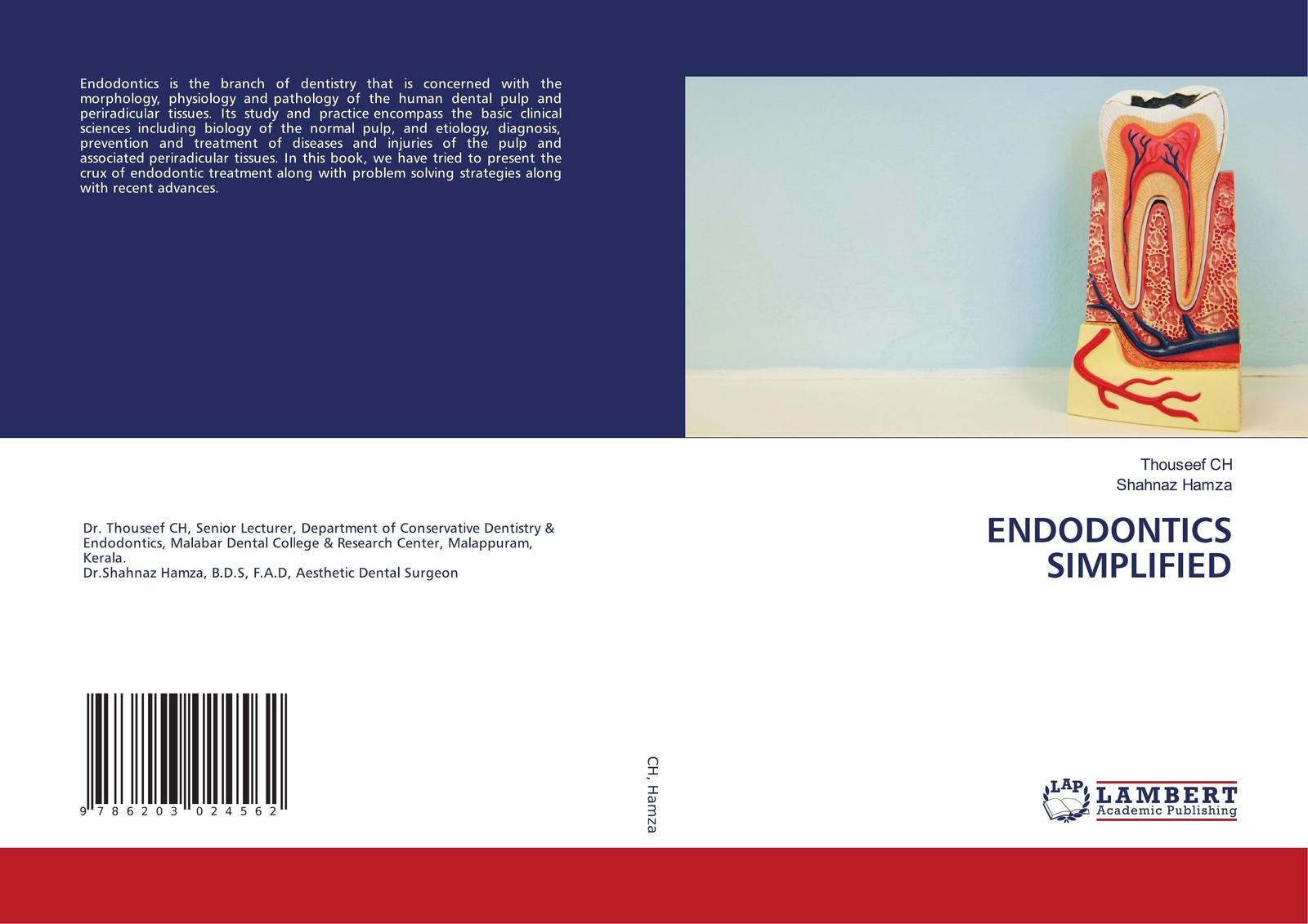 Thumbnail - Thouseef Ch (u. A.) | Endodontics Simplified | Taschenbuch | Englisch