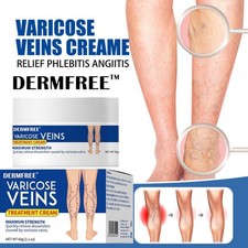 60g Varicose Veins Cream Varicose Veins Treatment for Legs Spider Vein Cream USA