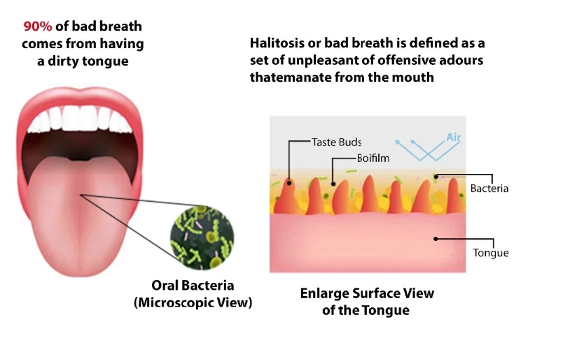 2x Ayurveda 100% Kupfer Zungenschaber, Zungenreiniger Zungenbelag Mundhygiene - Bild 3 von 4