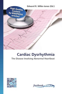 Cardiac Dysrhythmia The Disease Involving Abnormal Heartbeat Miller-Jones Buch