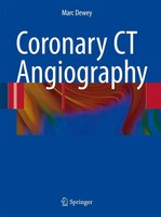 Marc Dewey | Coronary Ct Angiography | Buch | Englisch (2008) | Springer
