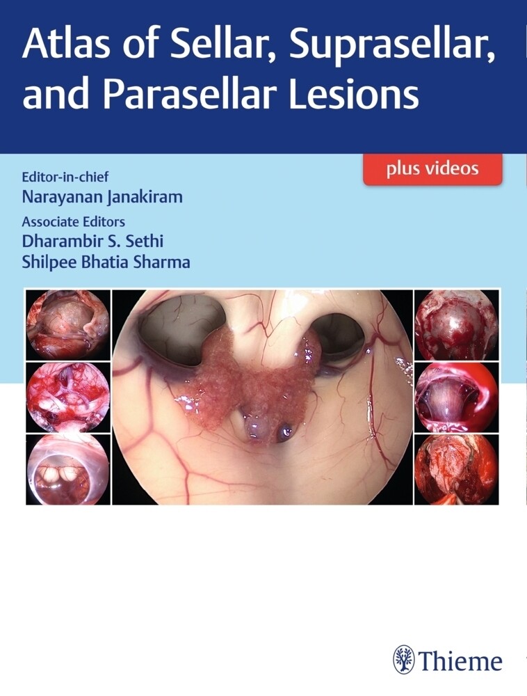 Thumbnail - Atlas Of Sellar, Suprasellar, And Parasellar Lesions | Narayanan