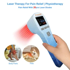 Handheld Cold Laser Therapy Multi Radiance for Morton's Neuroma Incisions Pain