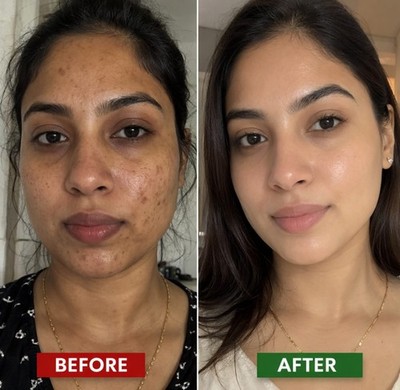 Skin Brightening Cream Faster Brightening for Dark Spots & Hyperpigmentation