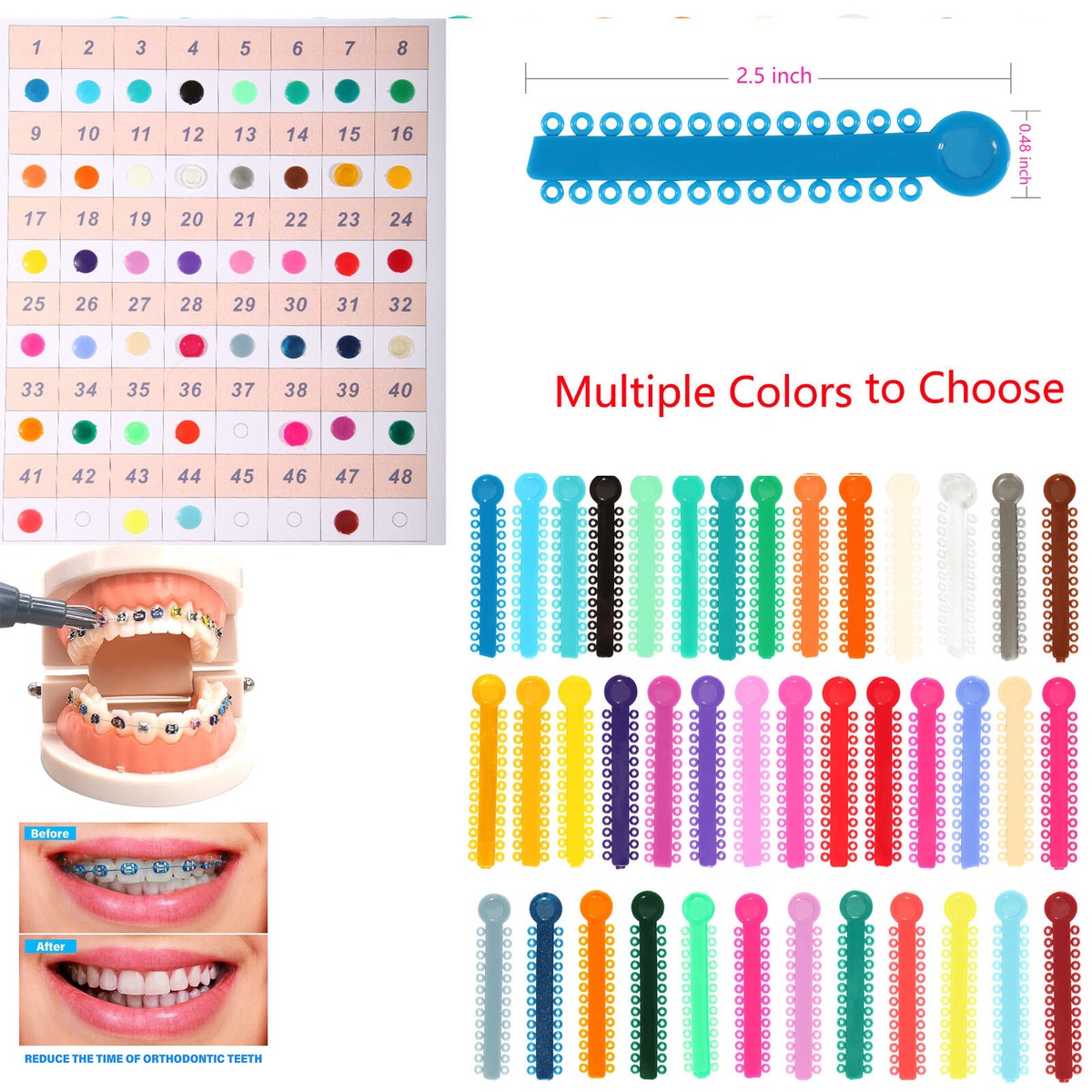 Élastiques Orthodontiques Double Couleur - Lot Pour Appareil Dentaire, Neuf