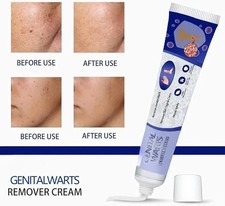 Genital Ointment Cream with Natural Ingredients for Skin care remove wart 20 gm