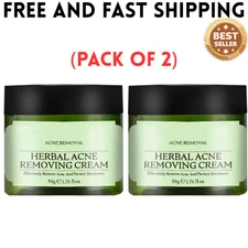 Acne Removing Face Cream,Natural Ingredients Professionally Remove Acne Marks,Fo