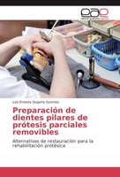 PreparacióN De Dientes Pilares De PróTesis Parciales Removibles Luis Ernesto Dug