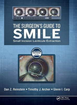 The Surgeon's Guide to SMILE | Small Incision Lenticule Extraction | Buch | 2018