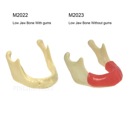 Modèle De Mâchoire Dentaire Avec Implant Pour Entraînement Au Perçage - Typodont 2022/2023, Neuf