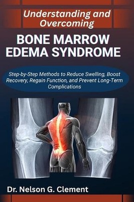 Understanding and Overcoming Bone Marrow Edema Syndrome: Step-by-Step Methods to