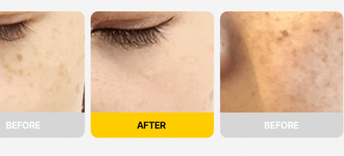 Reines Vitamin C 20% Ampulle DIFFER&DEEPER 2ml x 7ea - K-Beauty, UK Ware - Bild 13 von 23