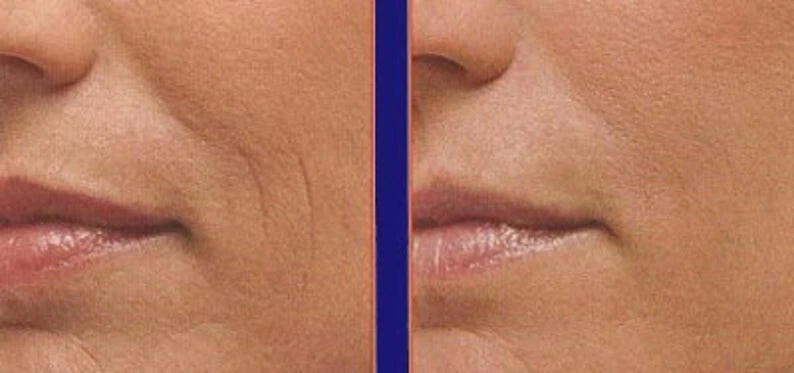 Peptide Collagen Serum AntiAging Wrinkle Cream-Matrixyl 3000 Hyaluronic Acid - Image 4 of 4