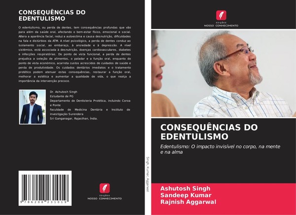 Ashutosh Singh (U. A.) | ConsequÊNcias Do Edentulismo | Taschenbuch (2024)-image