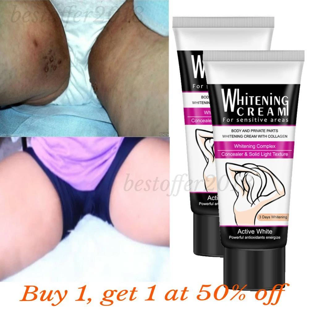 Whitening creams for inner thighs deals
