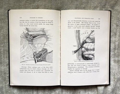 Antique Medical, Surgery Problems, Case Studies, Crile, Illustrated, 1928, VG - Picture 16 of 16
