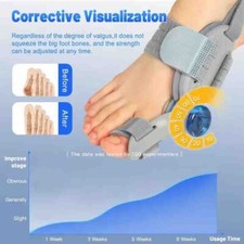 Bunion Fix Toe Valgus Corrector Big Toe Straightener Adjustable for Men  Women
