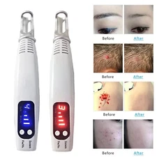 Professional Laser Picosecond Pen Blue&Red Tattoo Remover Acne Mole Scar Cleaner