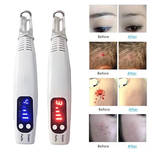 Penna laser professionale picosecondi blu e rossa rimozione tatuaggi acne talpa cicatrici detergente - Foto 1 di 17