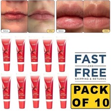 Remedy for Dry Lips Hydrating & Healing Lip Balm Ointment for Strawberry Flavor