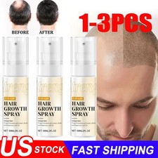 60ml 3X Halo Grow Hair Growth Spray, with Rosemary Biotin Ginseng for Hair Loss