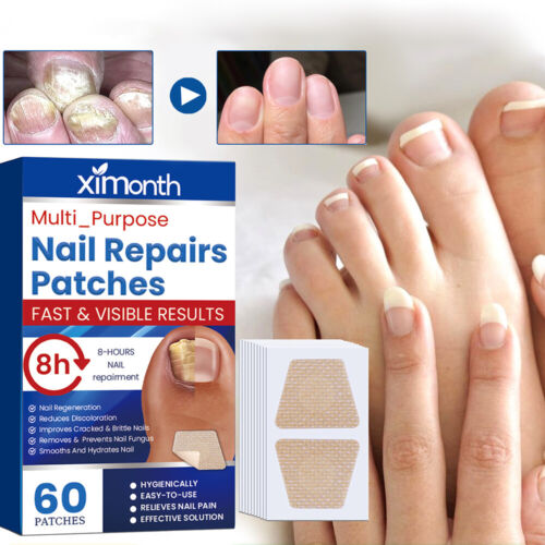 Toenail Fungus Treatment Sticker, 60Pcs/Box Nail Repair Patches Treatment