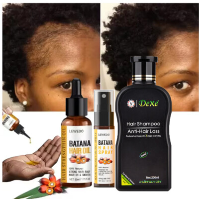 Hair Growth Oil Hair Regrowth Treatment Anti-Hair Loss Shampoo For Men & Women