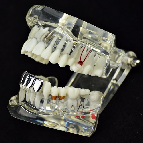 Grillz Cuatro 4 dientes dientes inferiores tono plateado fila inferior lisa hip hop parrilla - Imagen 3 de 6