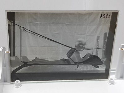 Antikes Glasnegativ, Kinderbehandlung, Lichtheliotherapie (R3 S1 B1 .72)