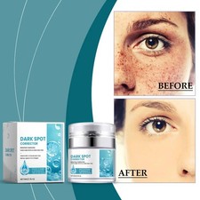 Dark Spot Corrector Cream 50g Whitening Brightening Moisturizer Facial Skin Care