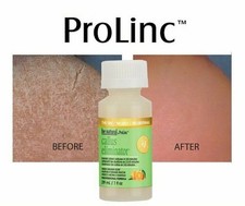 Prolinc Callus Eliminator 1oz Orange (4 Bottles)