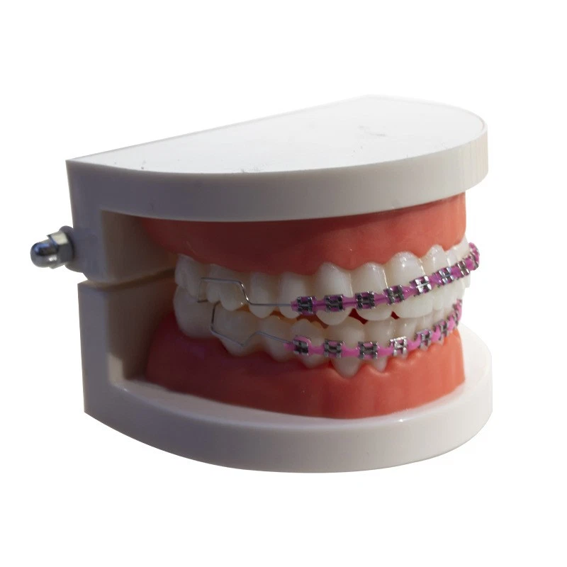 Moda Moda Falsos Brackets | Elegantes Accesorios Dientes Decorativos No Dentales Foto 4 de 4