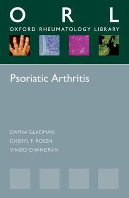 Psoriatic Arthritis, Paperback by Gladman, Dafna D., M.D.; Rosen, Cheryl F., ...