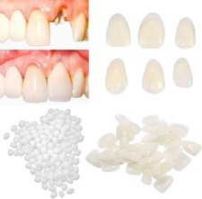 Tooth Repair kit for Filling The Missing Broken and Gaps-Moldable Fake...