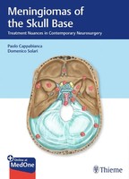 Meningiomas Of The Skull Base Paolo Cappabianca (U. A.) Bundle 1 Ebook Englisch