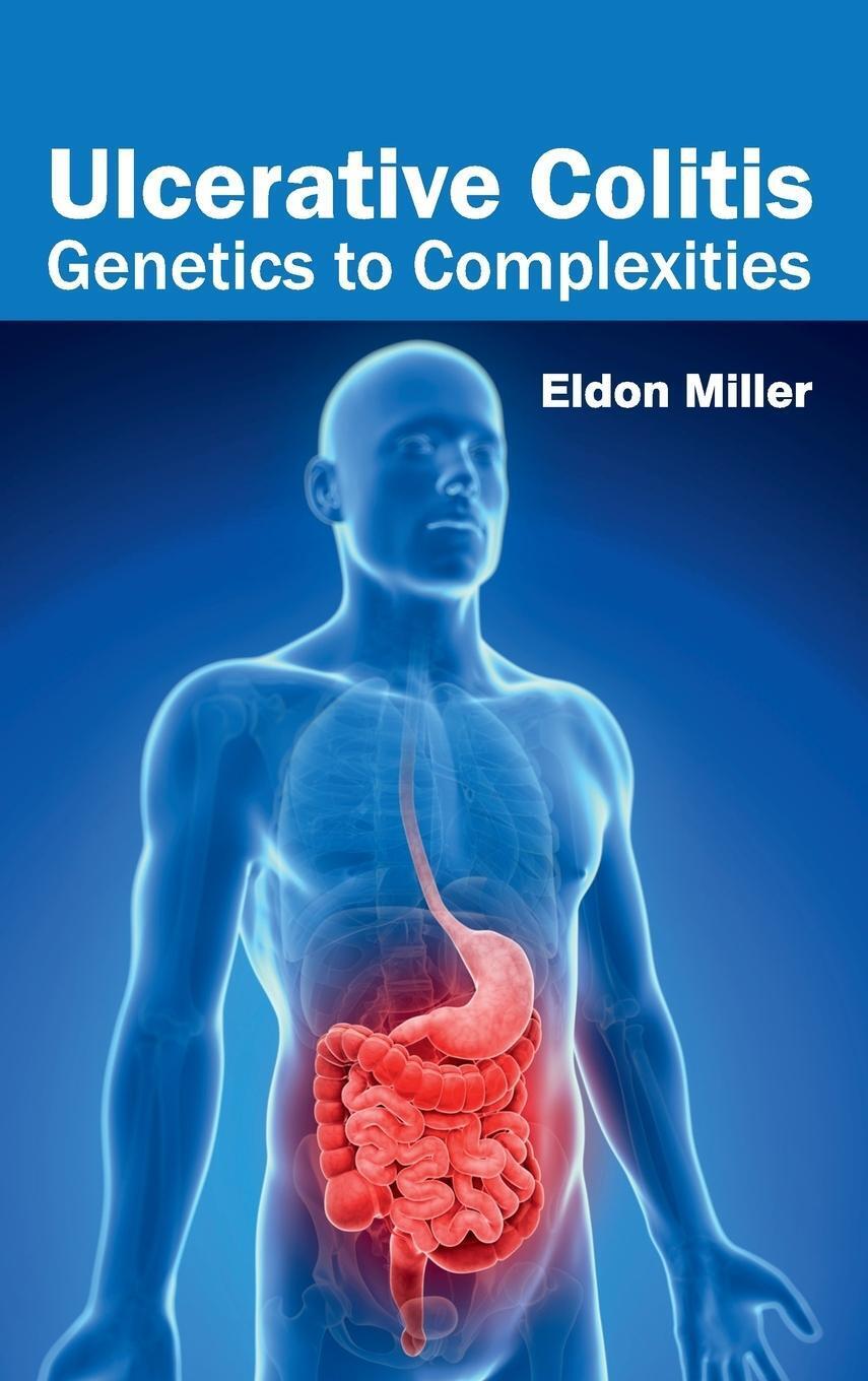 Thumbnail - Eldon Miller | Ulcerative Colitis | Buch | Englisch (2015) | Ean