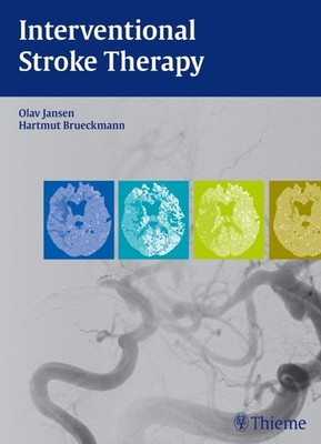 Interventional Stroke Therapy | Olav Jansen, Hartmut Brückmann | englisch