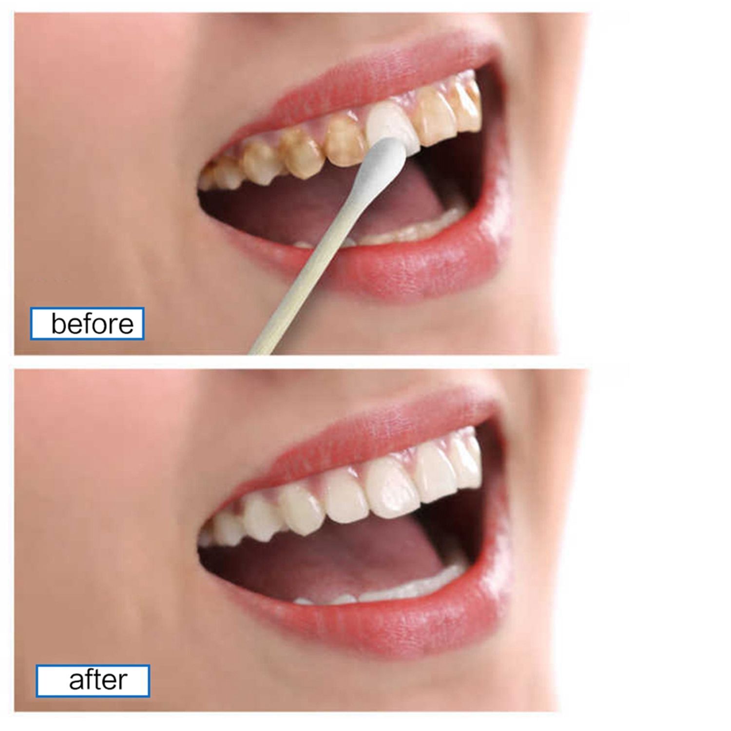 Coffee Tea Teeth Whitening Serum Gel Stain Remover Dentifrice Oral