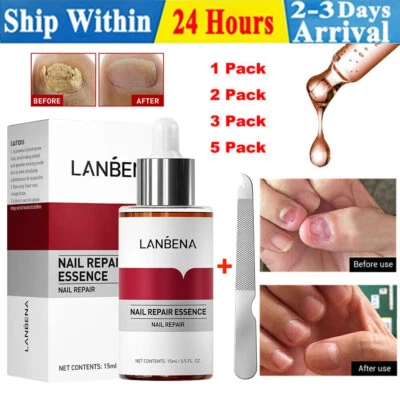 LANBENA 5/3X Repair Fungal Nail Essence Serum+ Nail File Hand Feet Treatment Nail Repair