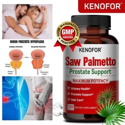 KENOFOR Saw Palmetto 4650mg - 120 Capsule Perdita di Capelli Vie Urinarie Prostata VEGAN