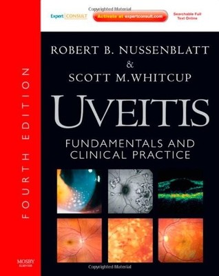 Uveitis: Fundamentals and Clinical Practice: Expert Consult - On