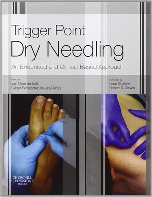Trigger Point Dry Needling: Evidence and Clinical-Based Approach