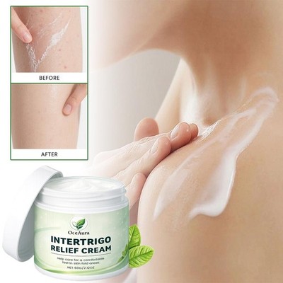 Intertrigo Relief Creme, Hautfalten Barriere Creme mit Oxid Zinksäure & S1X1