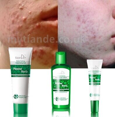 Anti Akne Gesichtsbehandlung Face Gel Lotion Und Cream Master Herb Tiande 3pcs Ebay