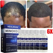 6X Minoxidil 5 Extra Strength Men Hair Regrowth Treatment 6 Month Supply 50ML