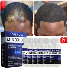 6X Minoxidil 5% Extra Strength Men Hair Regrowth Treatment 6 Month Supply 50ML