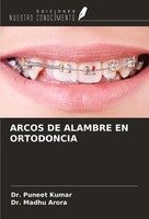 Puneet Kumar (U. A.) | Arcos DE Alambre EN Ortodoncia | Taschenbuch | Spanisch