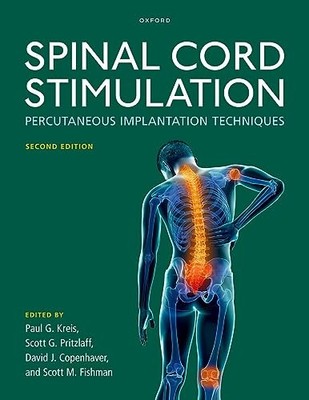 Spinal Cord Stimulation: Percutaneous Implantation Techniques by Paul G. Kreis