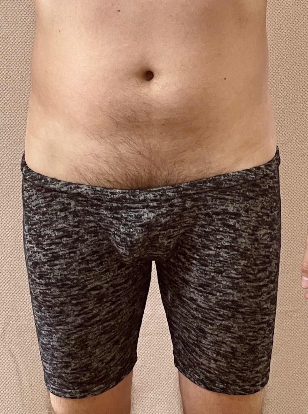 Picture 1 of 17