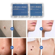 20Pcs Replacement Warts Rubber Ring For Painless Skin Mole Wart Removal Tool
